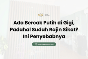 Ada Bercak Putih di Gigi, Padahal Sudah Rajin Sikat? Ini Penyebabnya