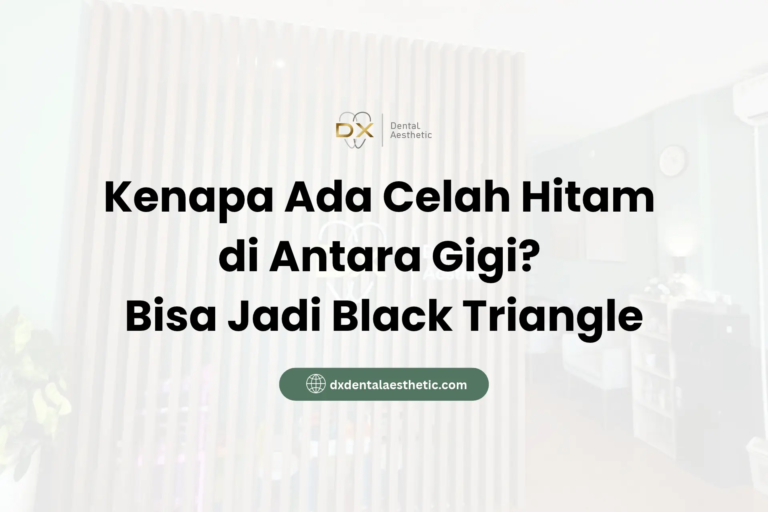 Kenapa Ada Celah Hitam di Antara Gigi? Bisa Jadi Black Triangle