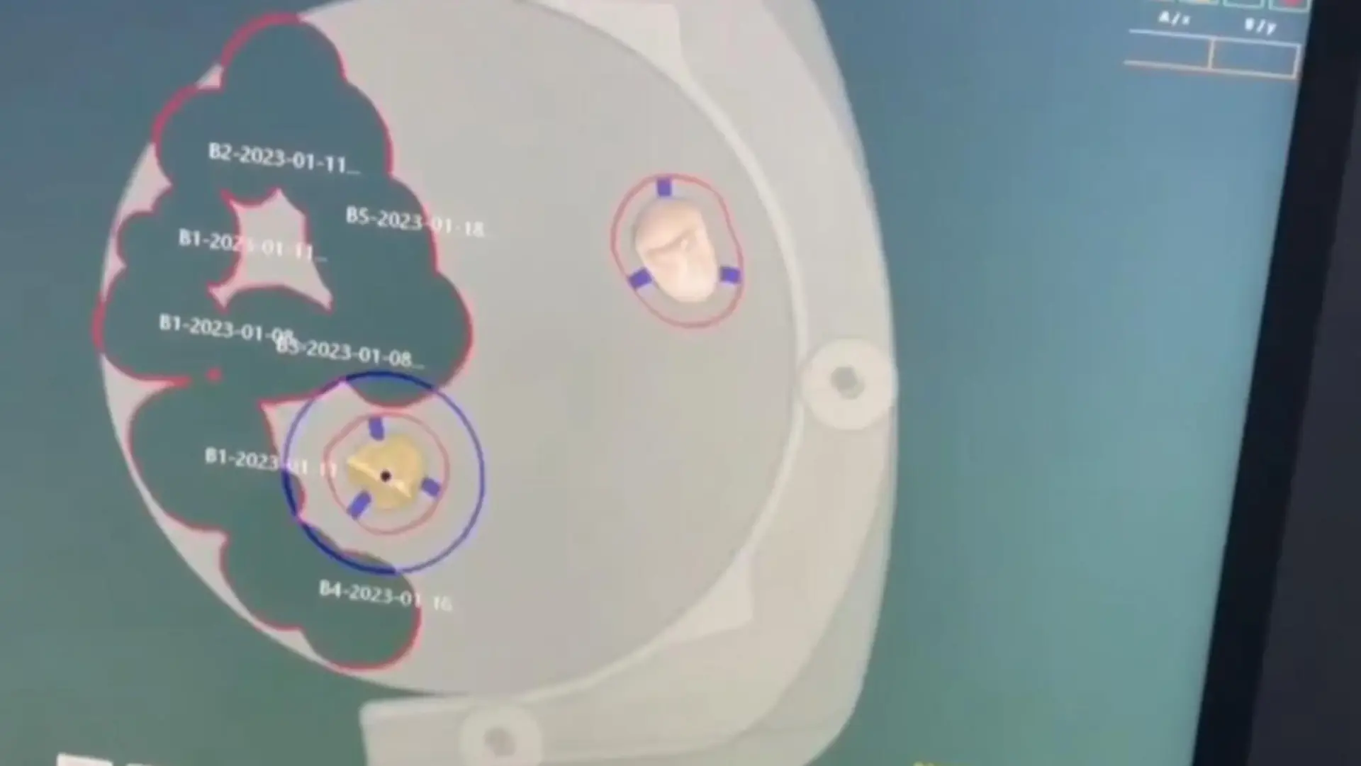 In House Laboratory - DX Dental Aesthetic