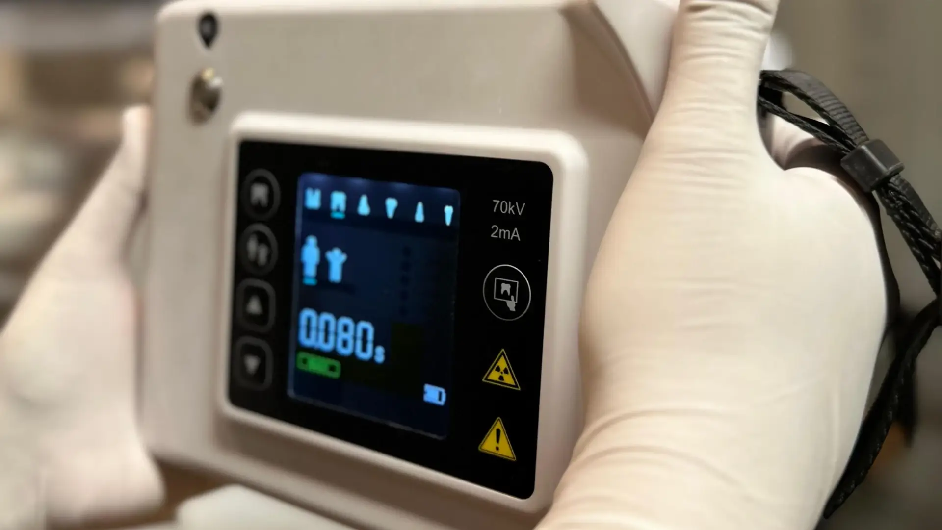 X-Ray Photo - DX Dental Aesthetic