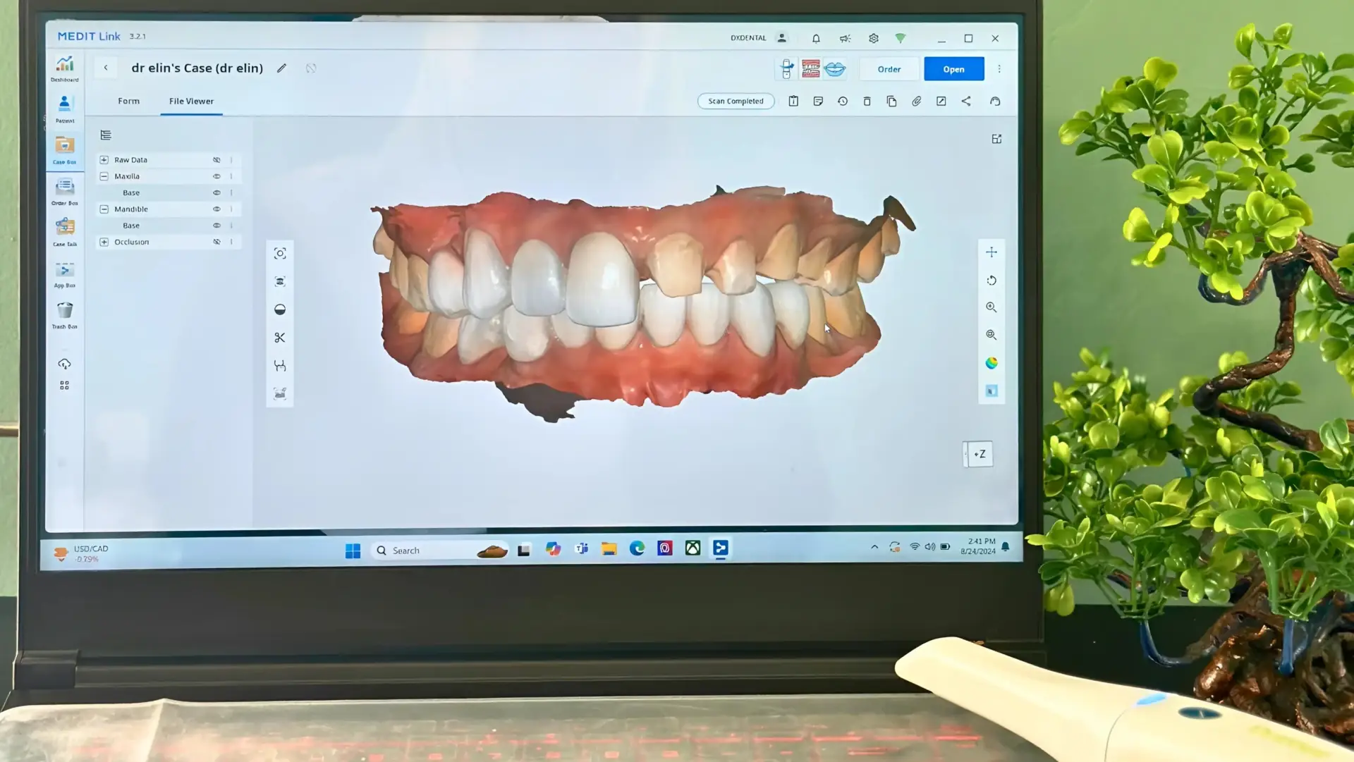 Intraoral Scanner by Medit - DX Dental Aesthetic